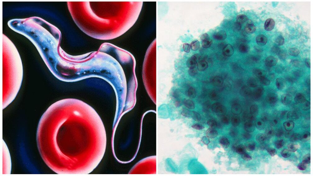 Pneumocysten im Körper