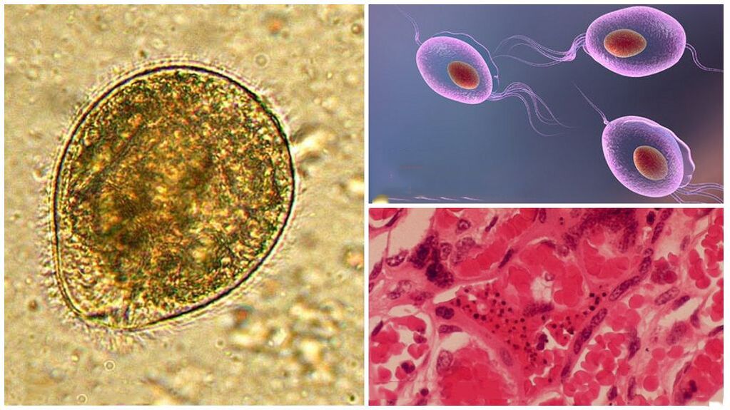 Wie Parasiten aussehen